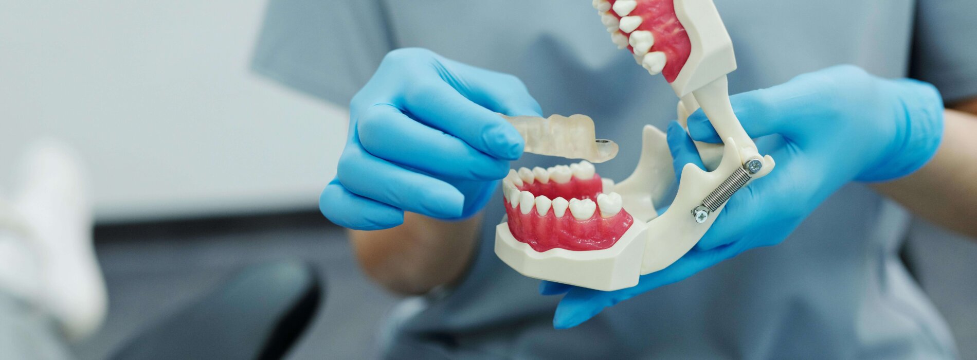 Implanty zębów – nowoczesny sposób na odzyskanie pięknego uśmiechu